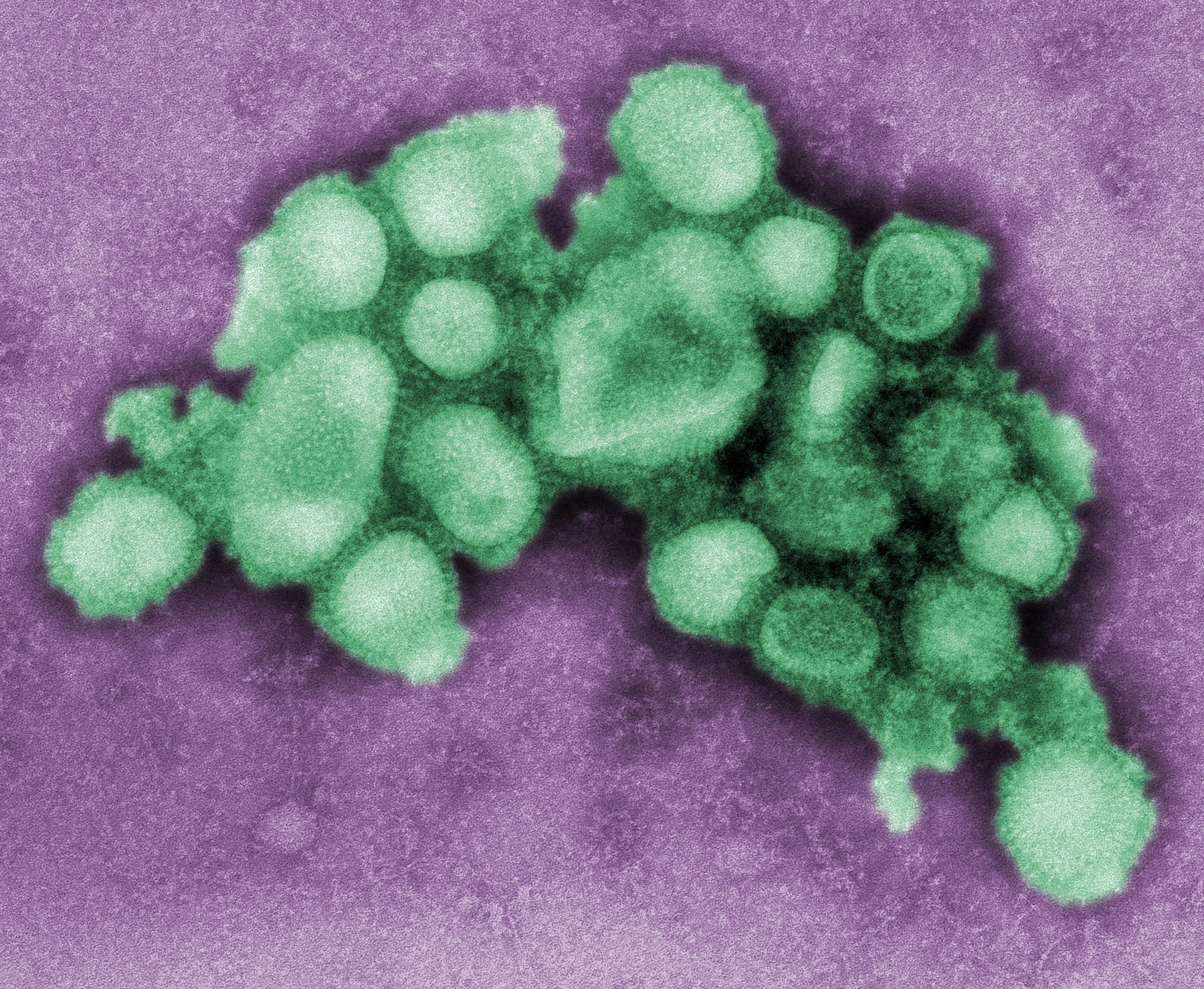Green digitally colorized influenza virions against a purple background in a CDC transmission electron micrograph
