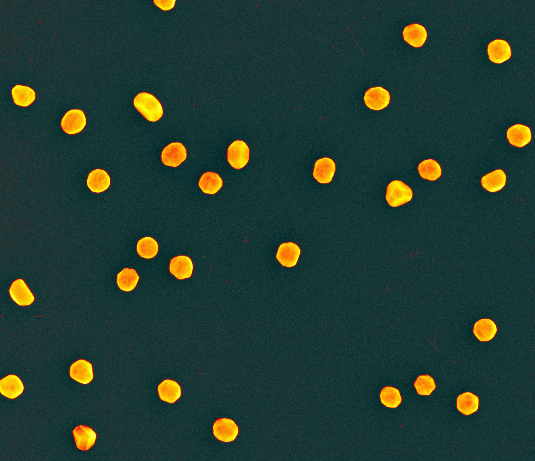 False-color SEM with bright golden nanoparticles against a dark background